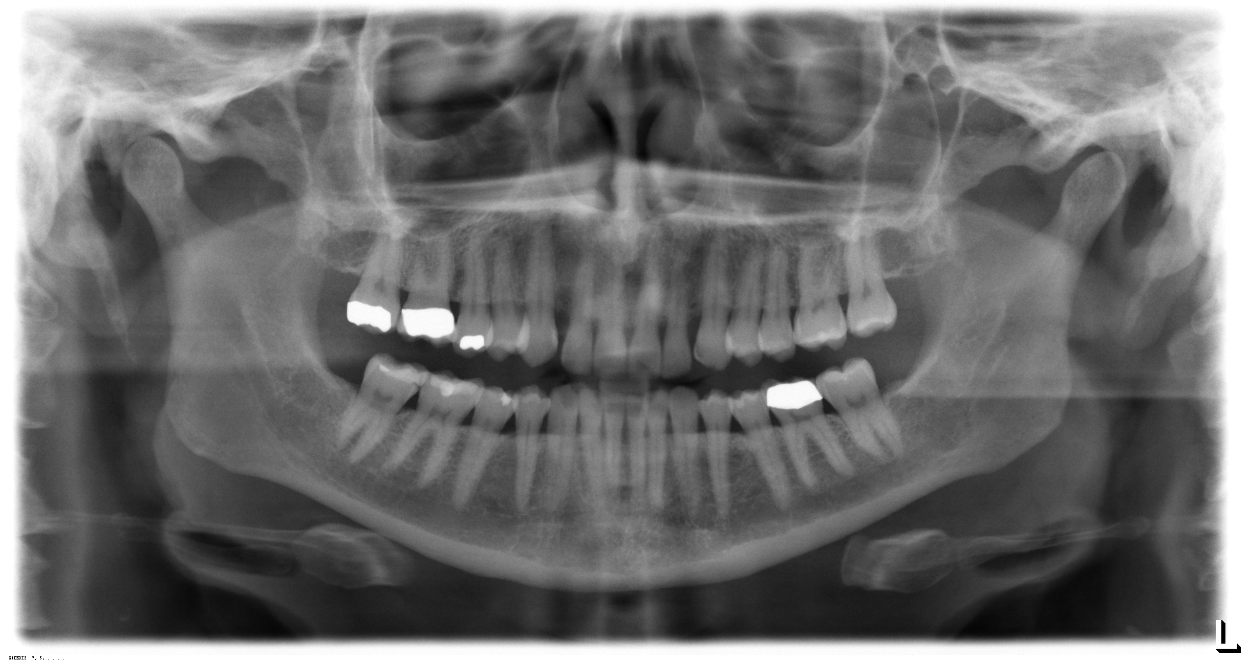 DIGITAL PANORAMIC AND INTRAORAL XRAYS